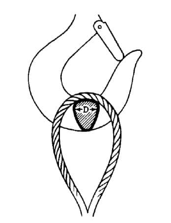 Wire Rope Slings General Information: Sling Eye Design